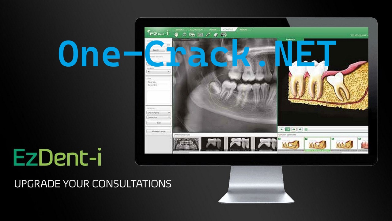 EZDent-I & Ez3D-i Full